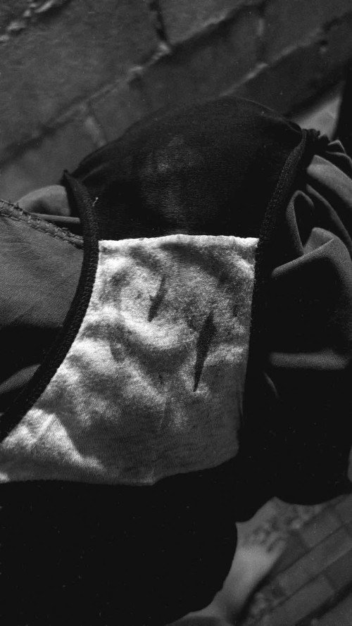 ท้อง7วีค4วัน มีเลือดออก