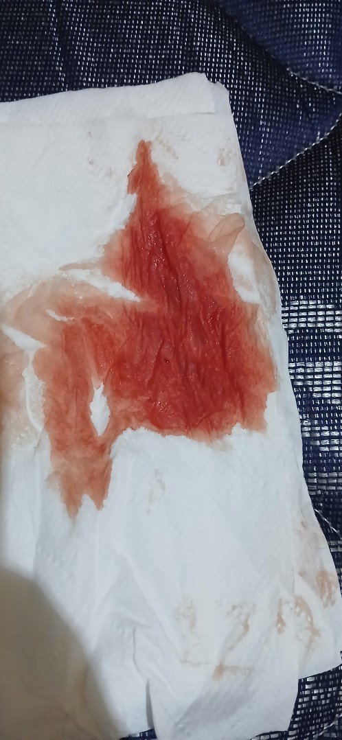 Ini kenapa ya bund kmrin flek coklat tapi hari ini keluar darah gitu ini di kehamilan 6 weeks