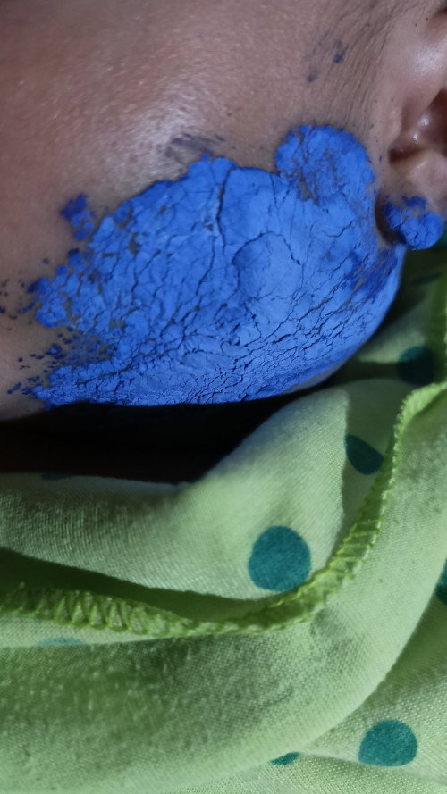 Bun, anak saya bengkak pipi sebelah kiri dibawah telinga kiri lebih tepatnya, umur bayi 3 bln,