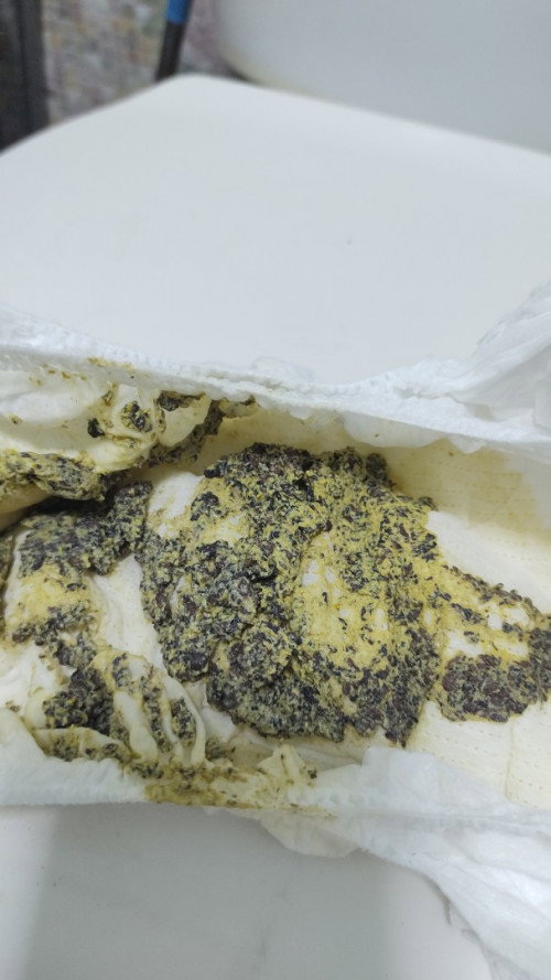 อึ น้อง9เดือน เป็นแบบนี้ ปกติไหมคะ ก่อนหน้านี้1เดือนท้องเสีย กังวลมาก