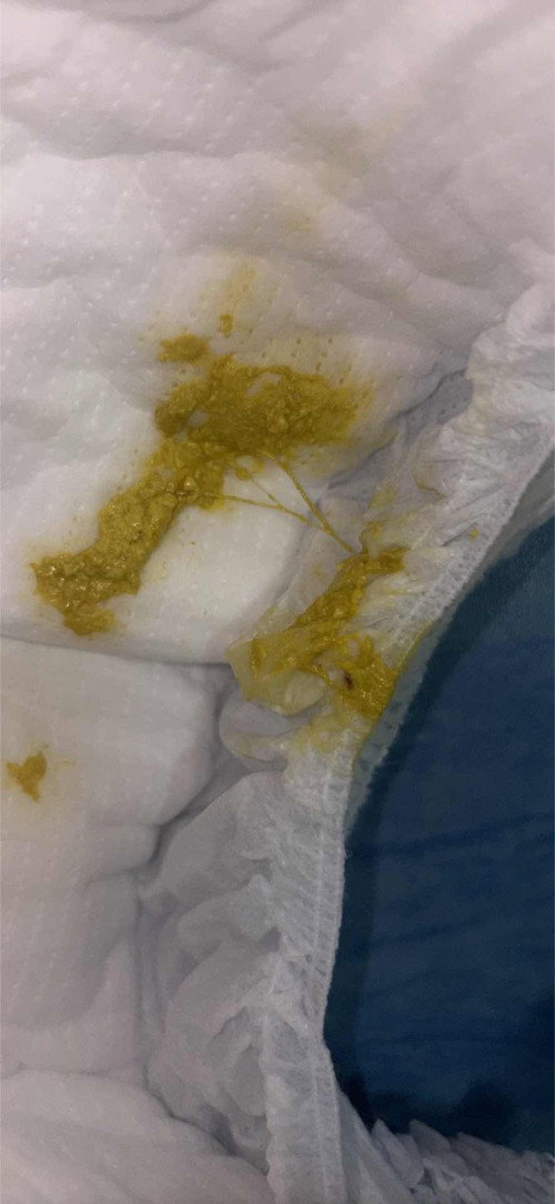 น้องถ่ายเป็นมูกแบบนี้ปกติไหมคะ