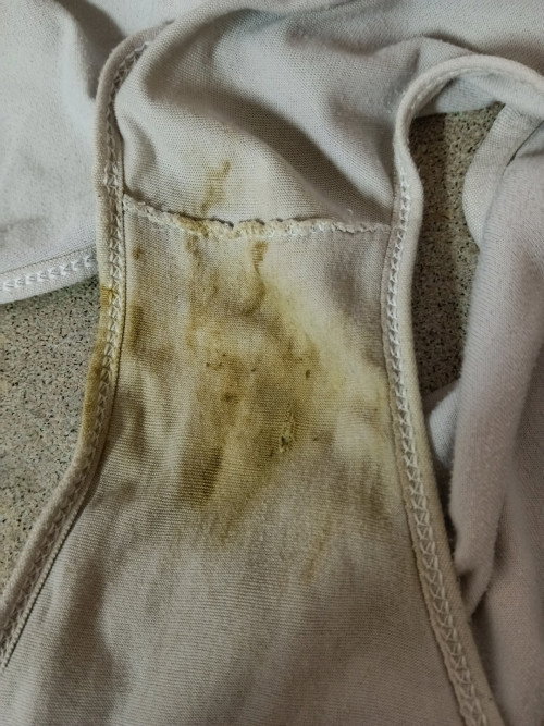 นำ้สีนำ้ตาลบนเกงใน