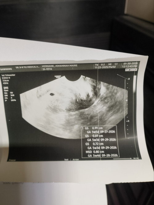 Unembryonic Pregnancy