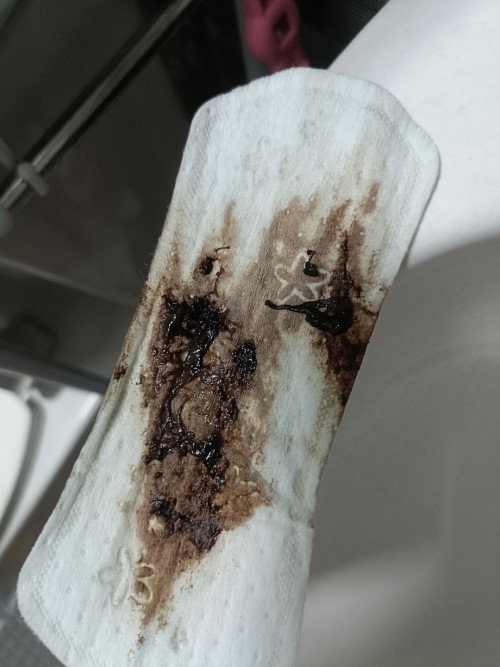 ไตรมาส2 อันตรายไหมคะ