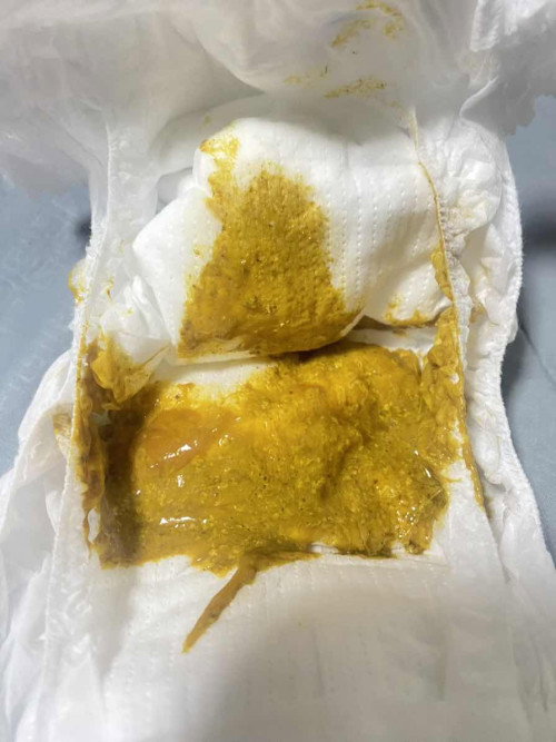 สอบถามเรื่องอึน้องค่ะ