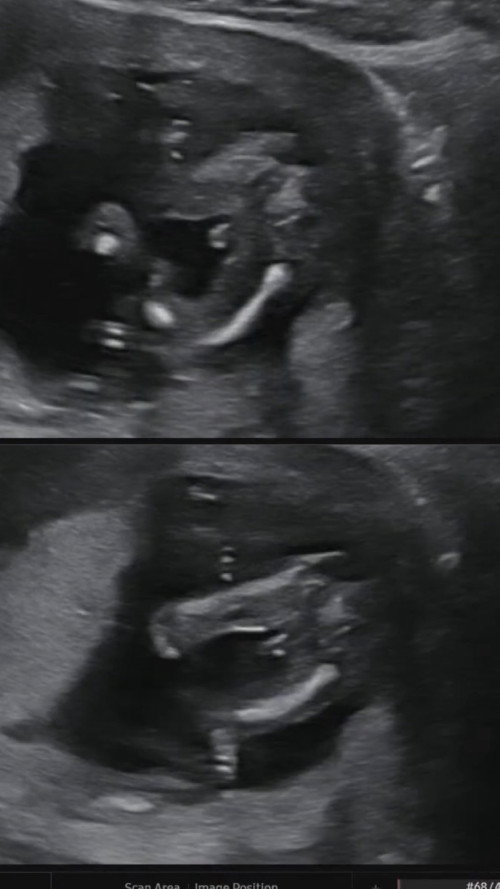 แม่ๆช่วยคอนเฟิร์มหน่อยค่ะ😂