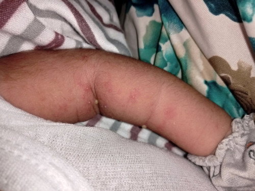 Mau tanya jenis gatal begini