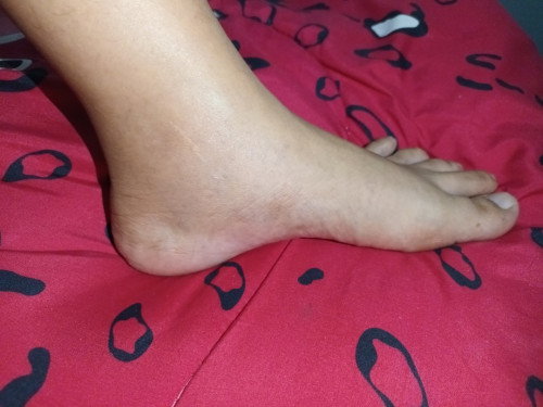 สอบถามแม่ๆ อายุครรภ์ 16สัปดา