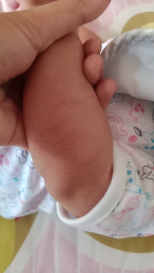 น้องมีอาการแบบนี้ค่ะ