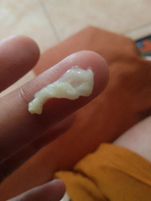 trimester 1 keputihan