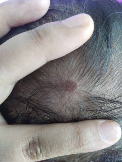 Ini kenapa ya bun info dong yg tauu