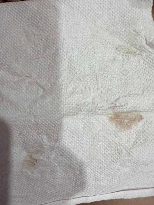 แบบนี้ใช่มูกเลือดมั้ยคะ