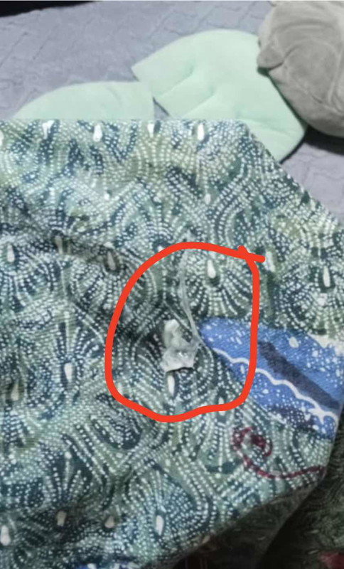 สวัสดีค่ะ แม่ๆสอบถามหน่อยนะคะอันนี้ใช่มูกไหมคะ 30w+3d ไม่มีอาการใดๆค่ะนอกจากท้องแข็งบางช่วงๆค่ะ