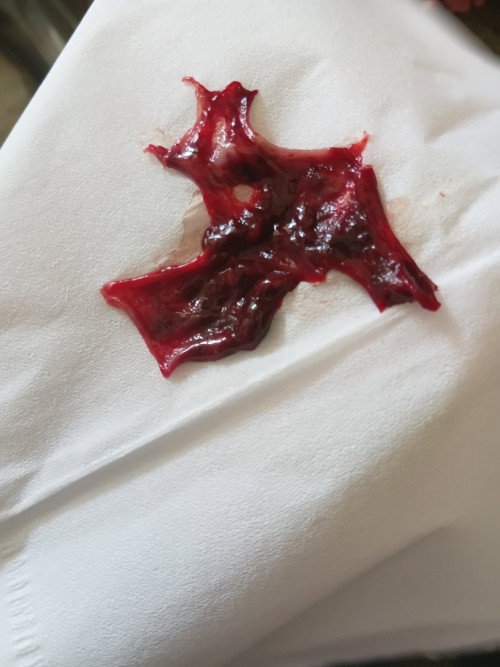 Bunda , mau tanya apakah ini darah keguguran?