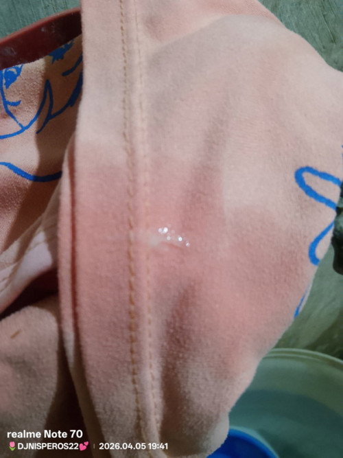 22 weeks and 5 days ( Discharge ) !