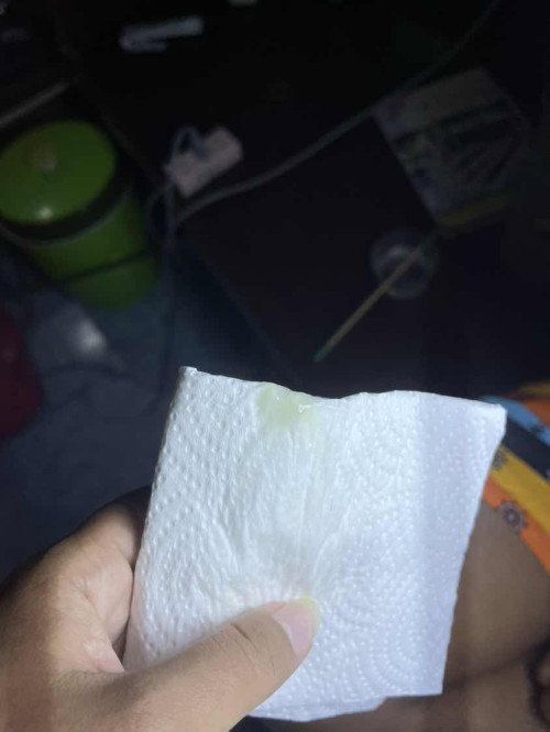 ท้อง30+4วีคมีน้ำเหนียวๆไหลออกมา