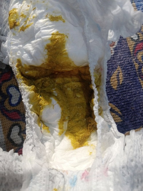 Maaf mau tanya kalo bab bayi 6 bulan 2 minggu berlendir apakah normal atau haru periksa ke bidan?