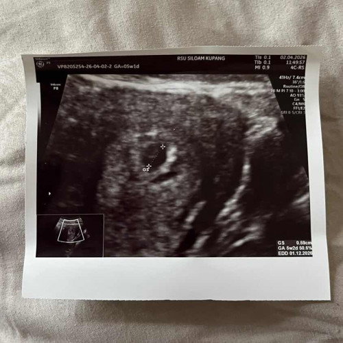 Mom to be👶🏻