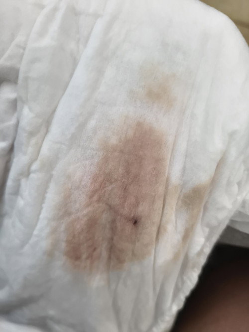 อันนี้ใช่เลือดมั้ยคะ