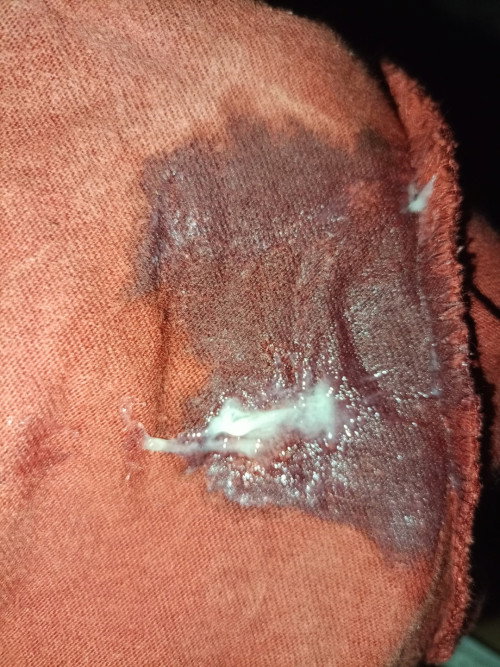 Mucus plug na po ba ito ?