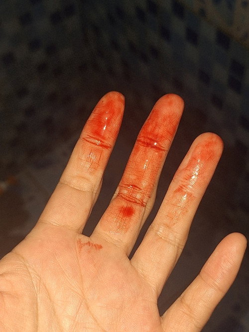 เลือดออกตอน6วีค