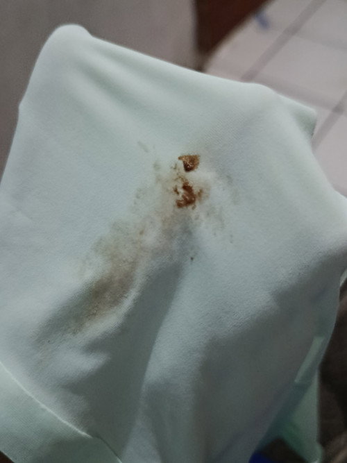 Ngflek diumur kandungan 7W2D