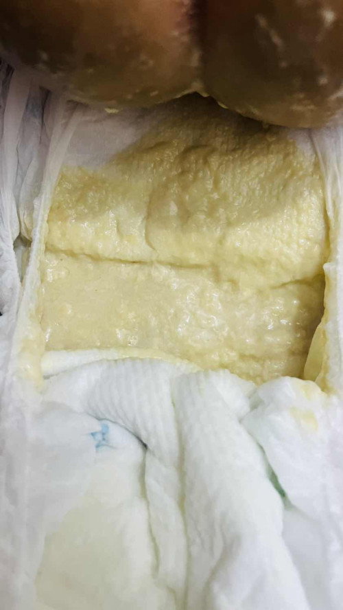 Help po! Meron ba dito same case saken?