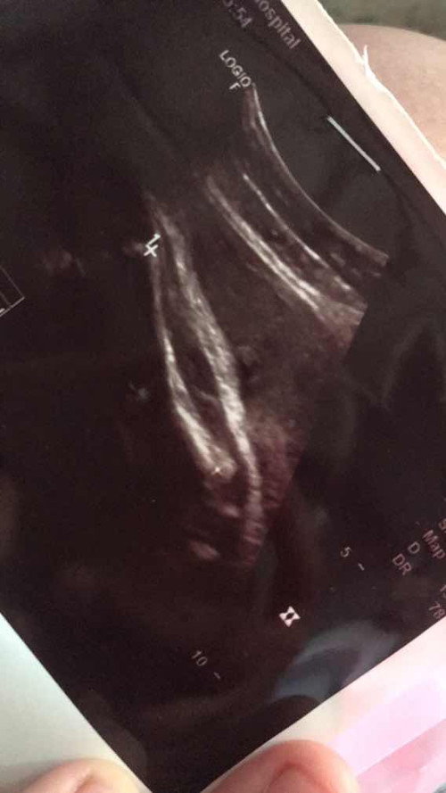 อันนี้ส่วนไหนของน้องจ่ะเเม่ๆ พอดีพึ่งเปิดสมุดดูหลังจากออก รพ เห็นคุณหมอติดมาไห้1รูป ท่าส่วนขา พอจะรู้ไหมเพศไหน🙏🏻🙏🏻🙏🏻🥰