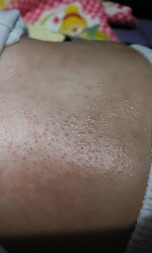 mams, ada yang bayinya begini juga gak ya setelah pake transpulmin, bayiku 5 bulan bgini... i