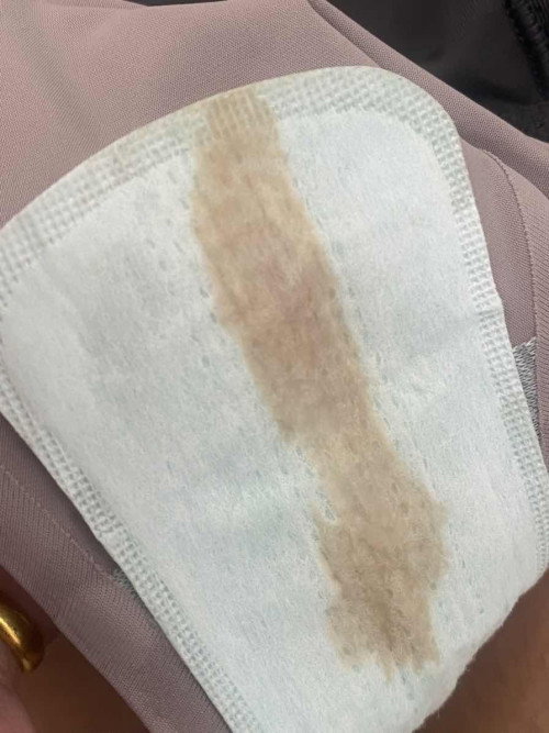 สีแบบนี้ใช่ตกขาวปนเลือดไหมคะ