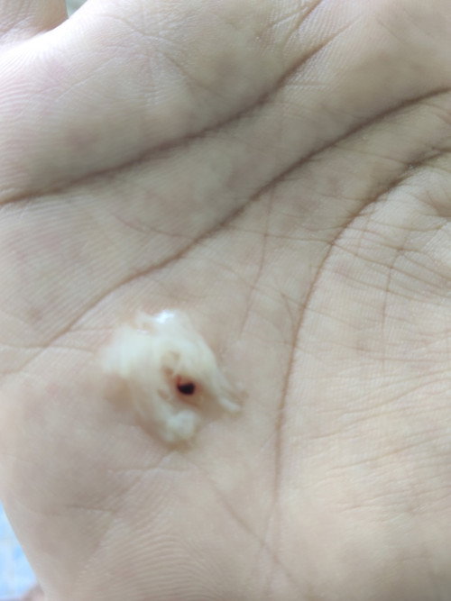 มีเลือดออก