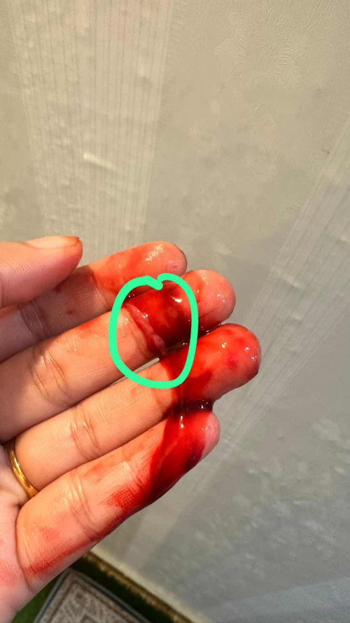 period atau chemical preg ye