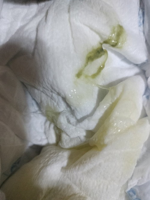 1WEEK BAGO MAG POOP SI BABY