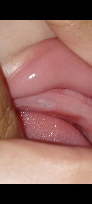 Digusi anak ku ada yang tajam seperti gigi, apakah mau muncul gigi bund?
Kalau diraba keras bund