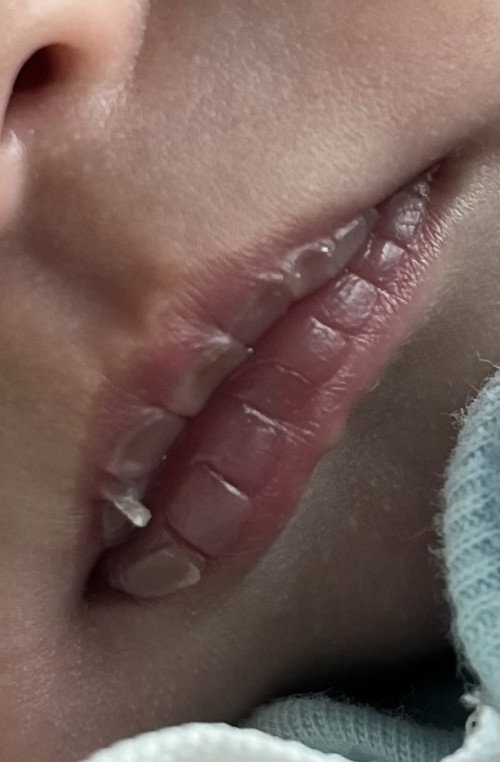 น้องได้ 14 วัน