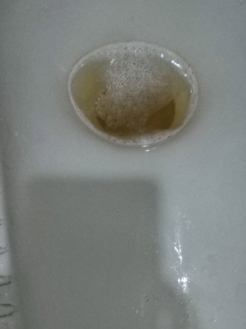 Urine berbusa seperti ini, kehamilan sudah 26 minggu