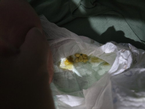 Pup bayi kenapa yah?