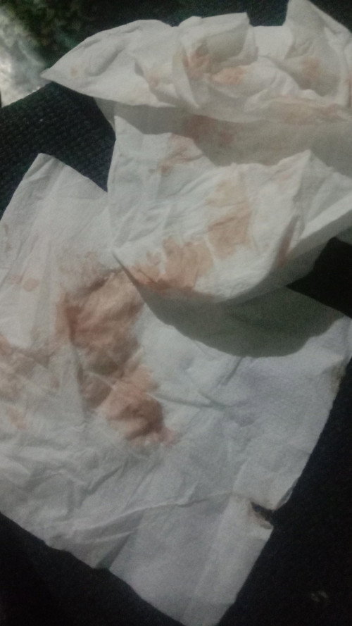 Keluar lendir merah kecoklatan