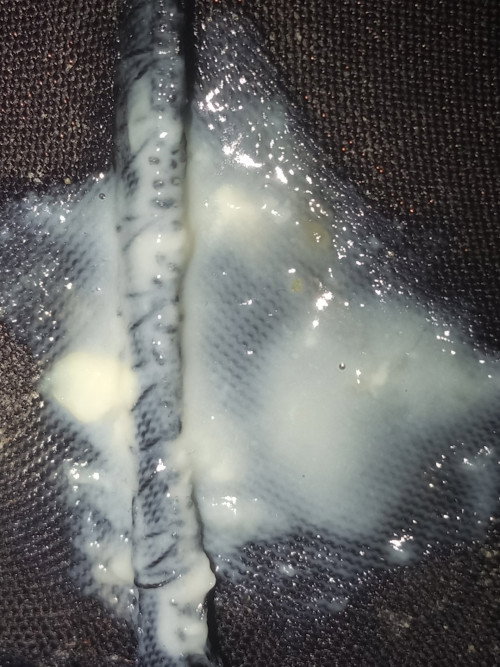 pasintabi po. tanong ko lang kung ano tong lumabas sa'kin. tapos sumasakit puson ko.