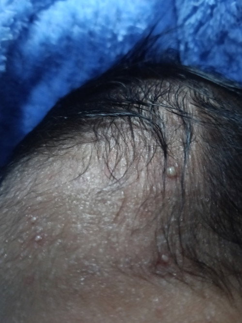 Obat apa yang bagus bun