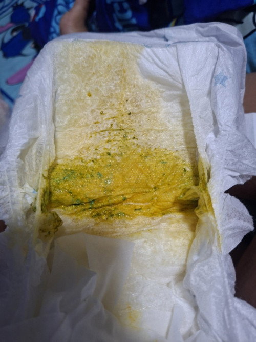 น้องอึแบบนี้เป็นอะไรมั้ยคะ