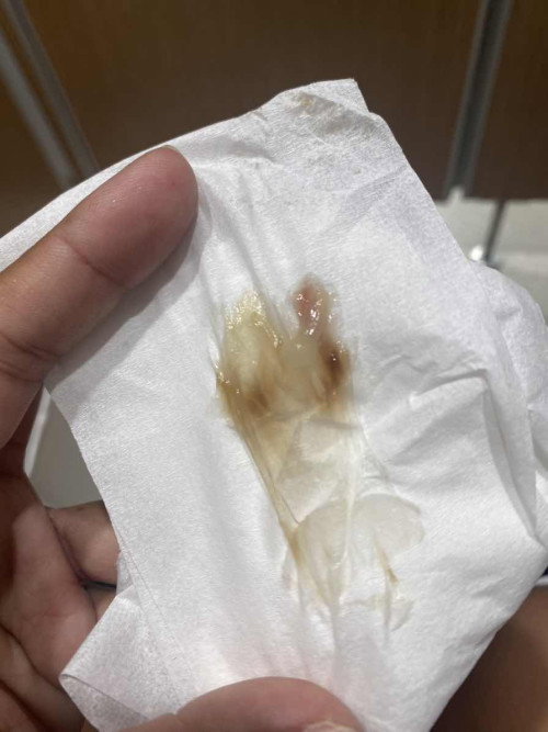 แบบนี้ต้องไปหาหมอไหมคะ