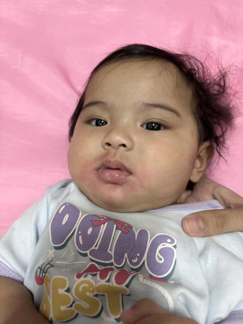 นมผสม แบบนี้แพ้หรือไม่