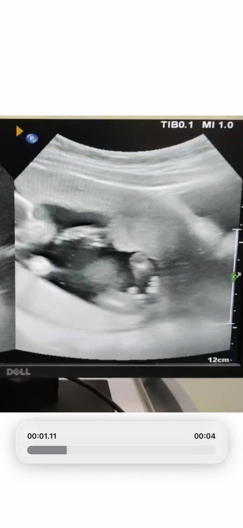 แบบนี้ชายหรือหญิงคะ 15+5w