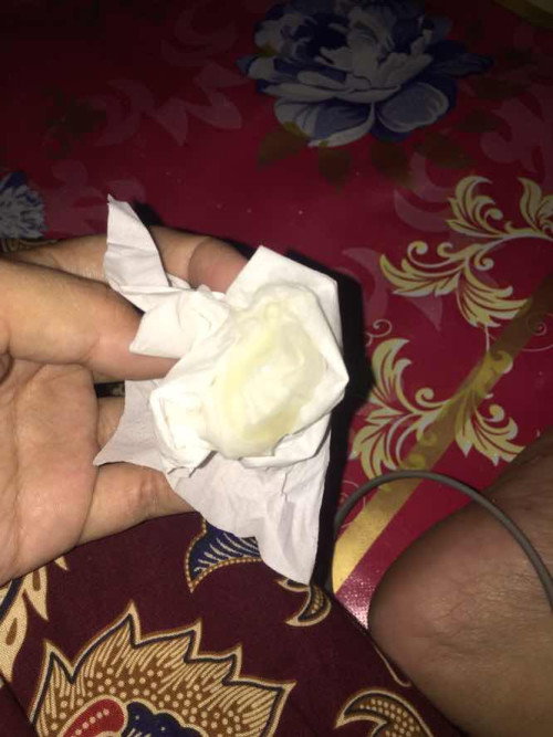 Usia kehamilan 34minggu