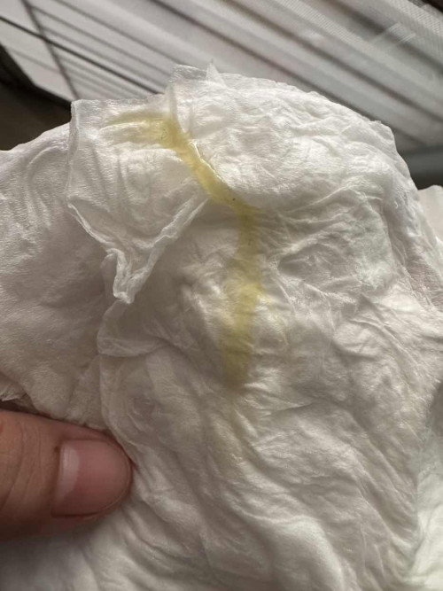 ท้อง 39+4 แบบนี้ปกติไหมคะ