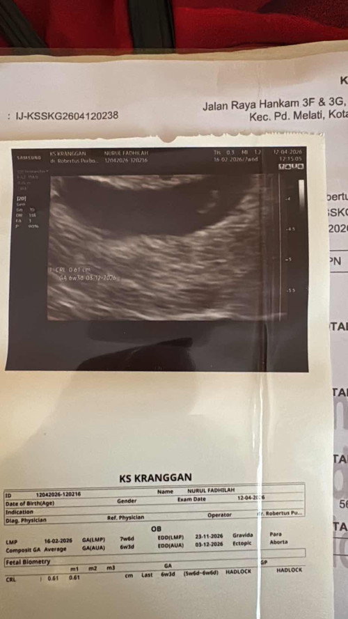 Usia kehamilan yang berbeda