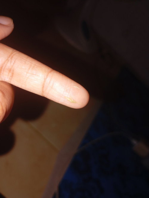 Ini flek apa keputihan ya bun