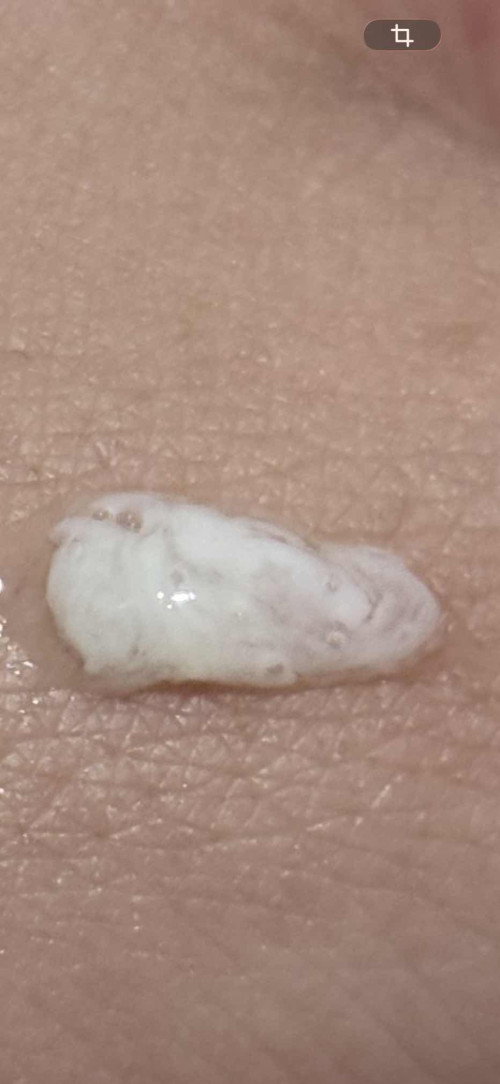 มูกใกล้คลอดมั้ย 39+1w