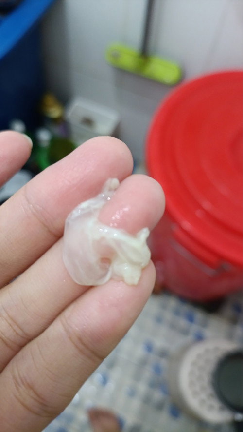 Tadi pipis keluar ini apa ya? Kondisiny lagi hamil 10minggu. Kira2 ini bahaya tidak untuk kandungan?